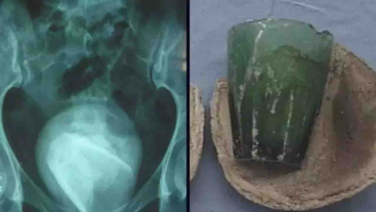 Trending ಸುಖದ ಮತ್ತಿಗಾಗಿ ಹುಚ್ಚುಸಾಹಸಕ್ಕೆ ಬೀಳುವವರಿಗೆ ಅಪಾಯ ಕಟ್ಟಿಟ್ಟ