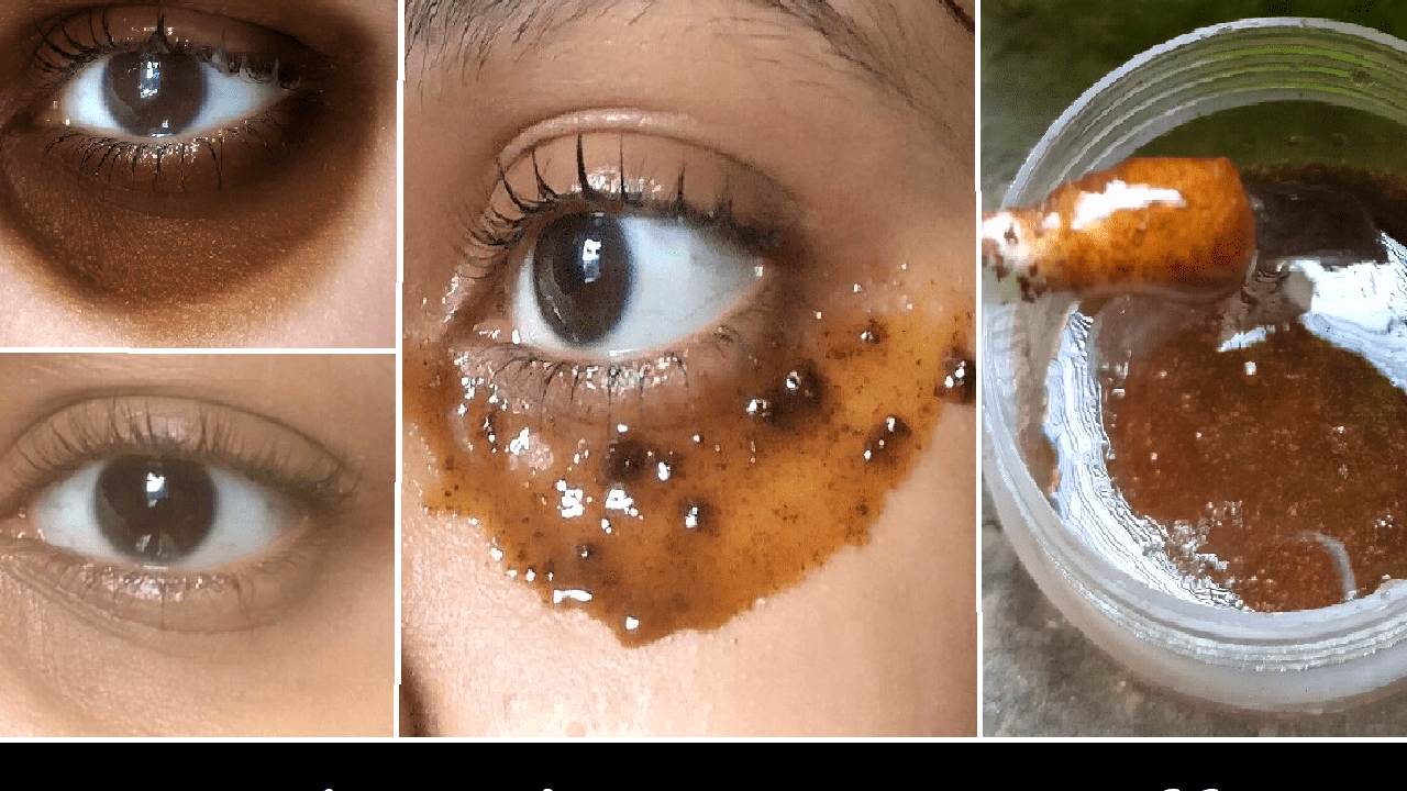 Try this simple home remedy to reduce dark circles under your eyes
